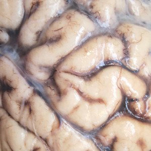 like brains on the side walk  feat.MC Strange