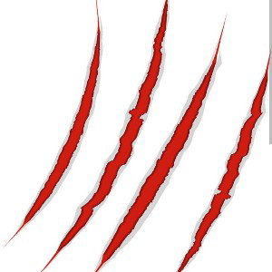 Scars 