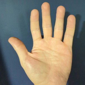 HANDS UP