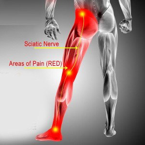fuckin sciatica