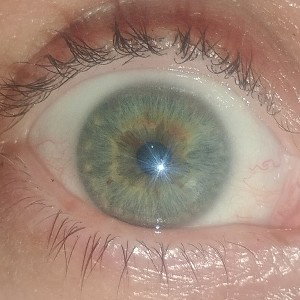 turned a blind eye