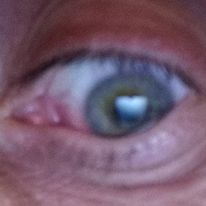 eye for an eye