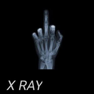 Parafraz - X-RAY