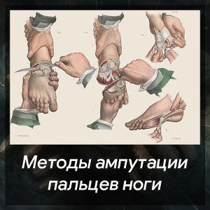 Это что-то вроде Чокапая