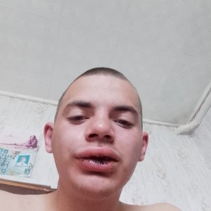 щека