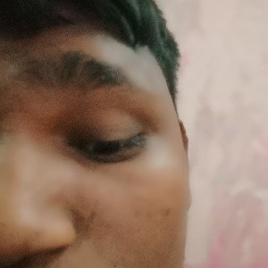Hyper